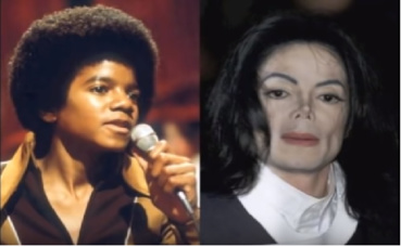 Changement physique radical de Michael Jackson (c) youtube Stop au blanchiment de la peau Changement physique radical de Michael Jackson (c) youtube Stop au blanchiment de la peau