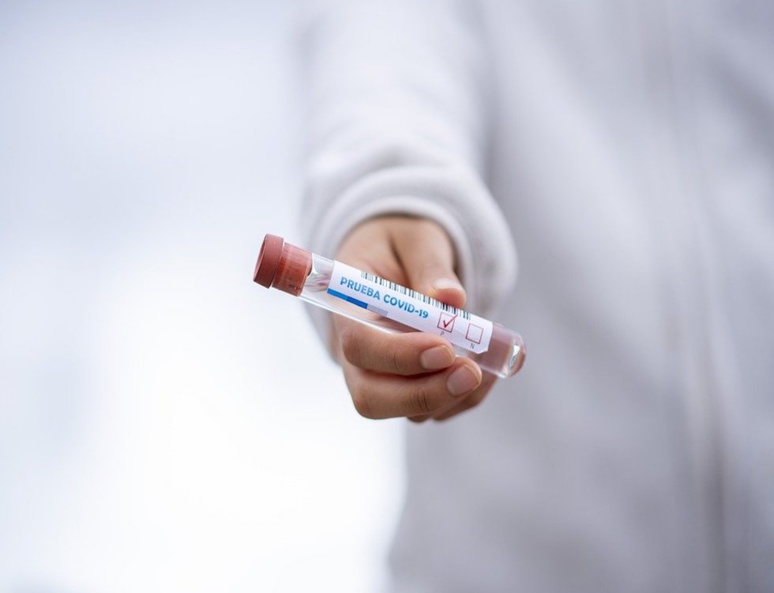 La Chine autorise un premier vaccin contre le Covid-19 (C) fernando zhiminaicela