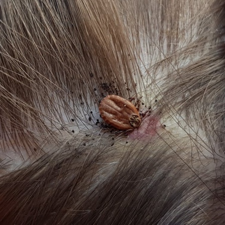 La tique Dermacentor s’installe parfois au niveau du cuir chevelu. Author provided La tique Dermacentor s’installe parfois au niveau du cuir chevelu. Author provided