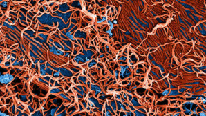 Le virus Ebola agrandi 25.000 fois. Photo (c) NIAID