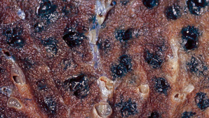 Photo (c) Dr. Edwin P. Ewing, Jr. Cliquez ici pour en savoir plus sur le cancer Photo (c) Dr. Edwin P. Ewing, Jr. Cliquez ici pour en savoir plus sur le cancer