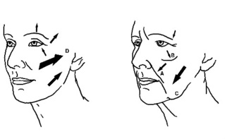 Illustration (c) GBdeZeeuw Illustration (c) GBdeZeeuw