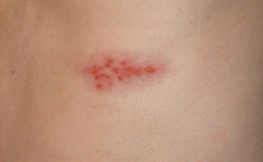 Photo (c) Preston Hunt Photo (c) Preston Hunt