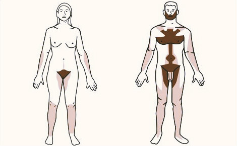 Scarica Gratis Images Le Top 3 Des Meilleures Techniques D Epilation le plus cool salutations