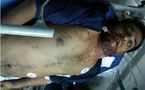 Les morts survenues lors de manifestations à Bahreïn mettent en évidence un recours excessif à la force par la police