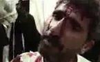 Au Yémen, des attaques violentes ont causé la mort de manifestants