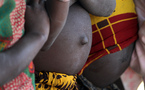 Un outil sur le web pour combattre la malnutrition 