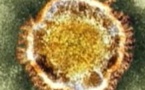 ACTU A LA UNE - Le nouveau coronavirus a déjà tué 18 personnes dans le monde