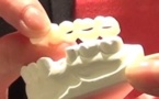 Imagina Dental 2014
