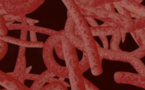 La menace d'Ebola