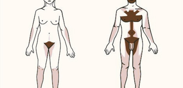 Le top 3 des meilleures techniques d'épilation