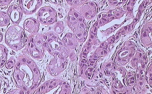 LA SOIRÉE DE L’ESPOIR