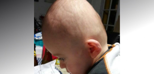 Une cagnotte pour Romain, atteint de brachycéphalie