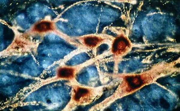 Ma pierre d'achoppement, mes malheurs, je ne m'en sors pas...