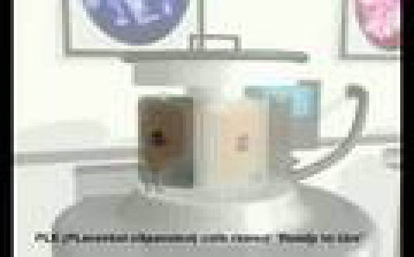 Premier essai clinique de la cellule souche dérivée de placenta sur l’être humain