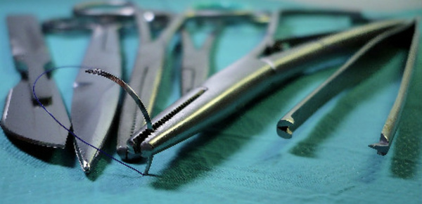 Essor du bistouri pour les Françaises, à quel prix?