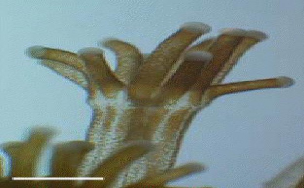 Qu’est-ce qui détermine la santé des coraux ?