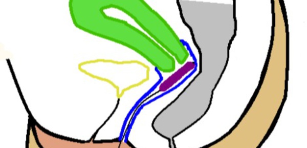 La terrifiante toxicité des tampons