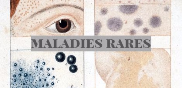 De nouveaux centres labellisés maladies rares