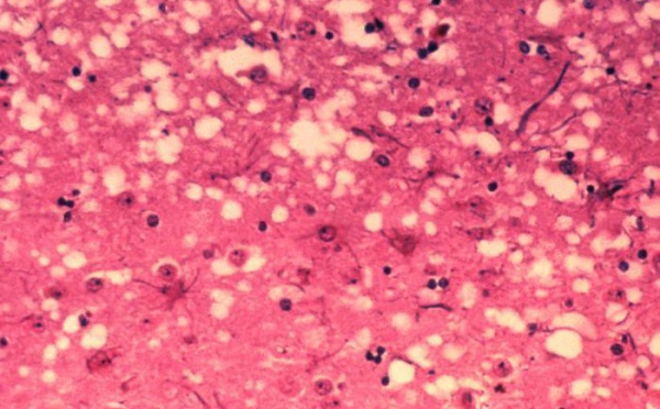 Fin de la maladie de la vache folle en Europe 