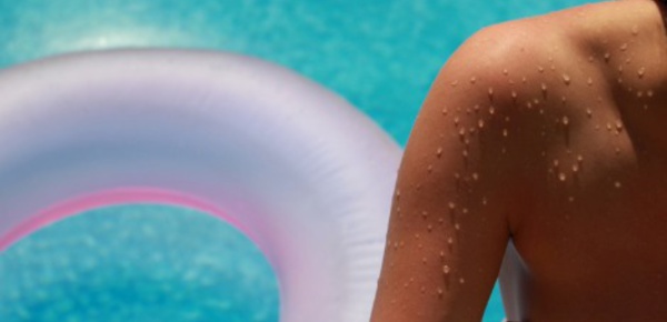 Le soleil brille, gare aux mélanomes!