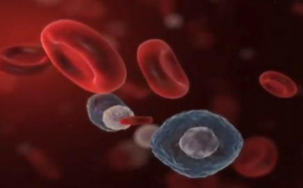 Nouveau test pour détecter les cellules cancéreuses