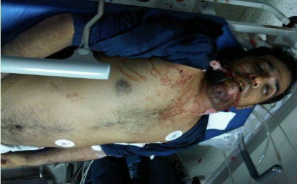 Les morts survenues lors de manifestations à Bahreïn mettent en évidence un recours excessif à la force par la police