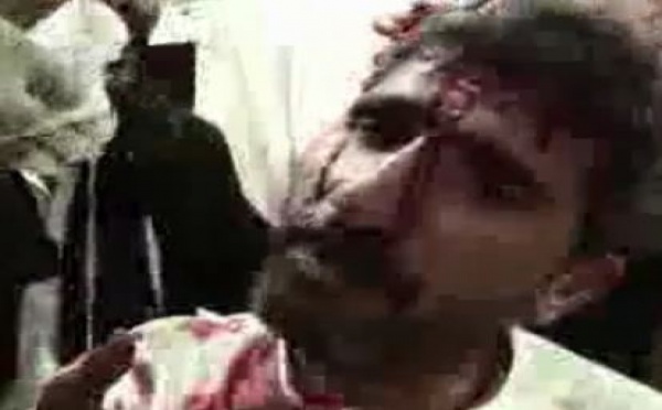 Au Yémen, des attaques violentes ont causé la mort de manifestants