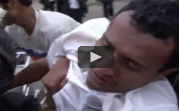 Les attaques meurtrières contre les manifestants sapent les projets de réforme au Yémen