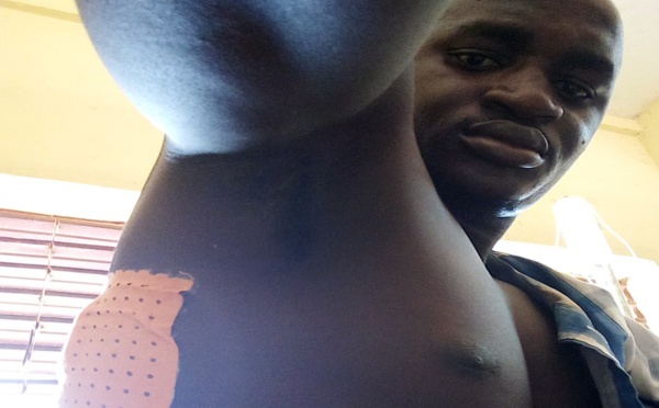 Guinée : Les souffrances d’un homme qui vit avec une balle dans son corps