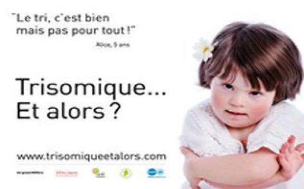 La trisomie 21 est la première cause de déficit mental d'origine génétique