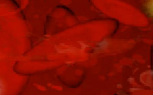 Journée mondiale de lutte contre la drépanocytose