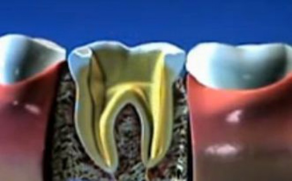 Esthétique dentaire