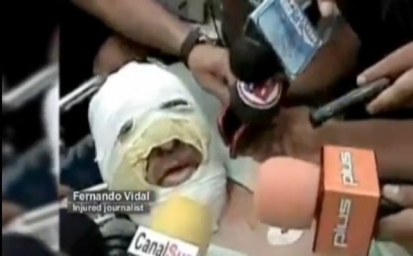 Un journaliste radio victime d'une terrible agression en Bolivie