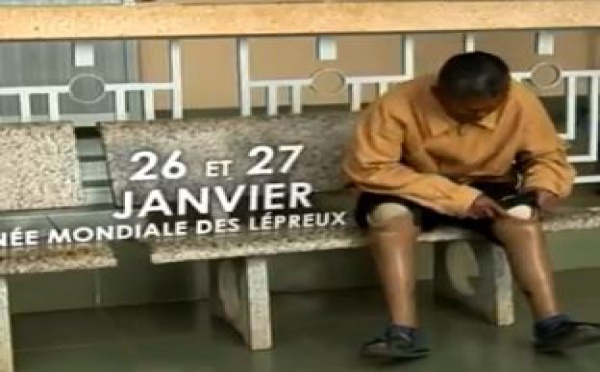 60e Journée Mondiale des Lépreux