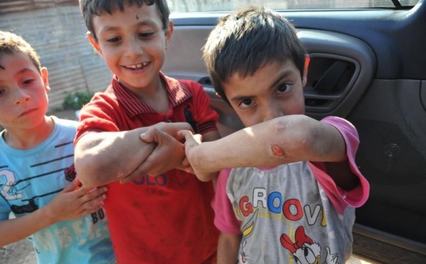 L’IMAGE DU JOUR – Blessures syriennes au Liban