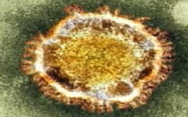 ACTU A LA UNE - Le nouveau coronavirus a déjà tué 18 personnes dans le monde