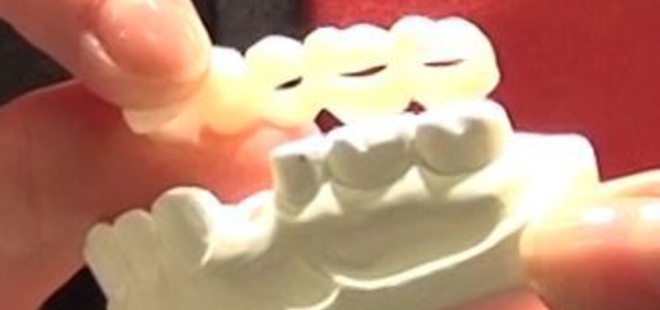 Imagina Dental 2014