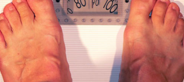 Régimes amaigrissants: pas sans risques