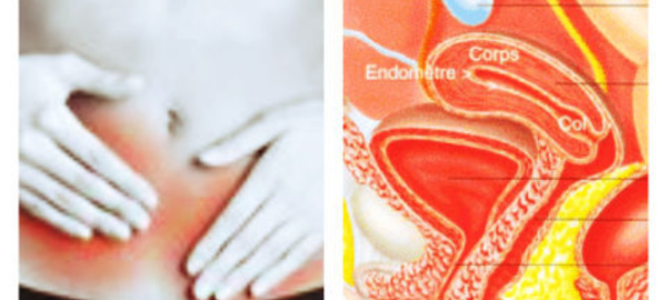 Faut-il encore enlever l'utérus?