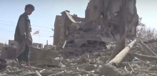 Ouvrir les yeux sur les souffrances au Yémen