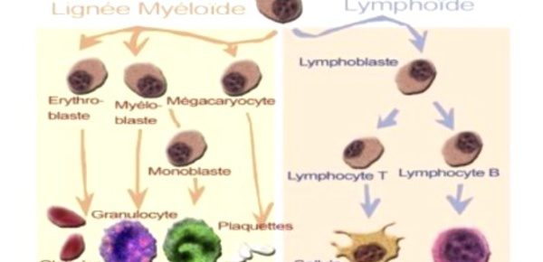 Une exposition au profit de la recherche contre le myélome